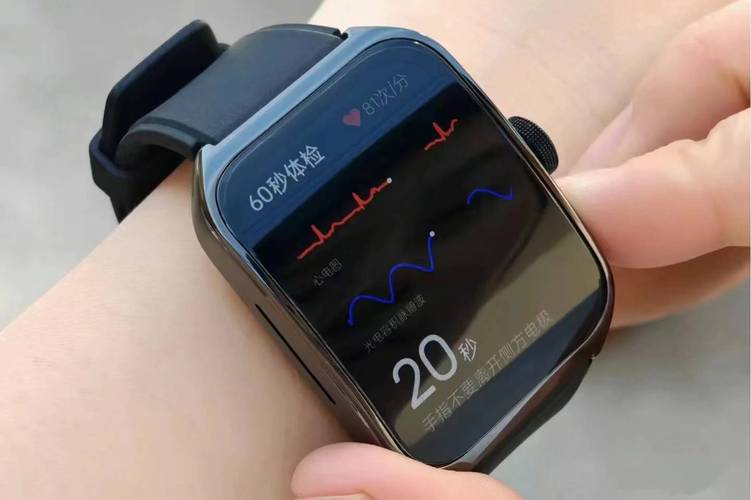 Apple Watch如何开启房颤提示软件记录_Apple Watch心脏健康高级监测教程