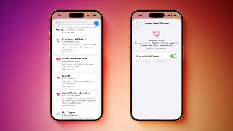 Apple Watch 怎么开启自动监测心律不齐_Apple Watch 房颤提示功能开启